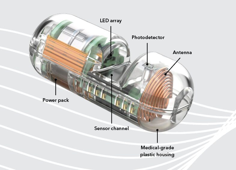 Novel point-of-care capsule to detect upper GI bleeding: initial real-world cases